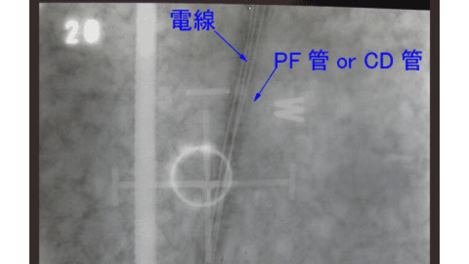 PF管やCD管が写っているレントゲンフィルム